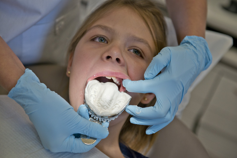 taking dental impression taking dental impression